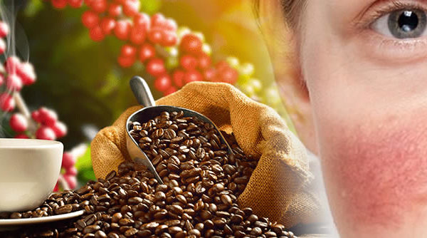 Descubren una relación entre el consumo de café y la rosácea