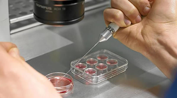 Influencia de la reserva ovárica en la fertilidad femenina