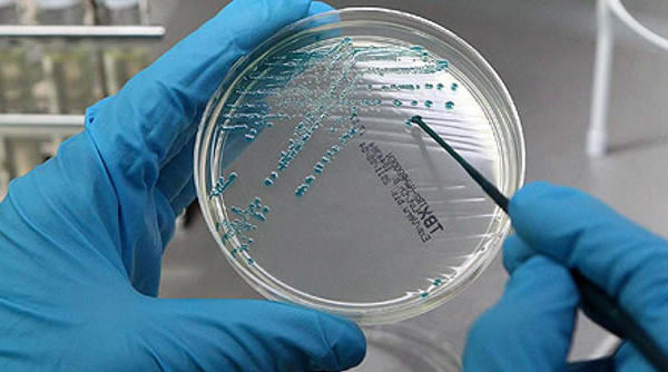 Bacteria E. Coli. Síntomas, fuentes y transmisión