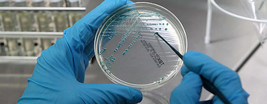 Bacteria E. Coli. Síntomas, fuentes y transmisión