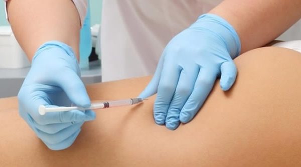Carboxiterapia para combatir la celulitis y rejuvenecer la piel