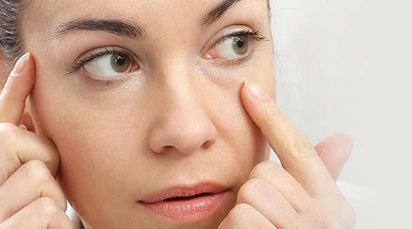Cómo recuperar la flacidez facial