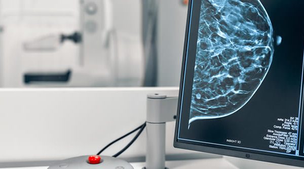 Inteligencia artificial y cáncer de mama
