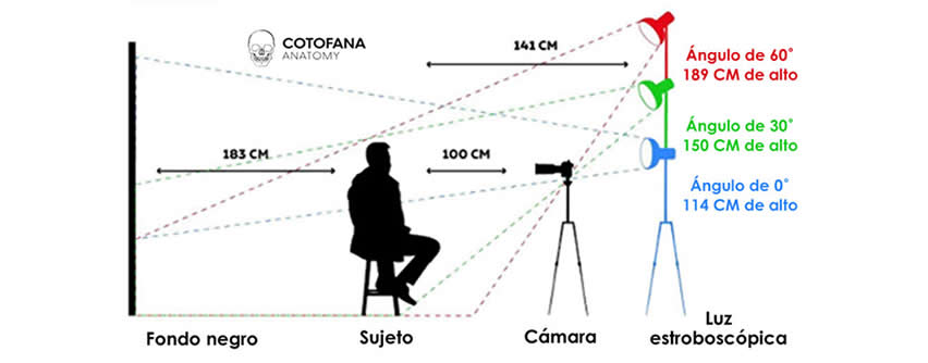 La influencia de diferentes ángulos de luz durante la evaluación fotográfica estandarizada del paciente sobre la percepción estética del rostro