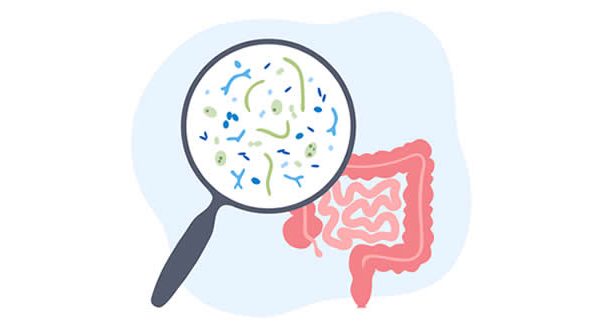 Los alimentos que quieren tus bacterias intestinales para una buena salud